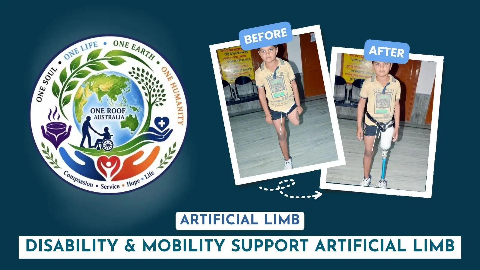 artificial-limbs-support-by-one-roof-australia